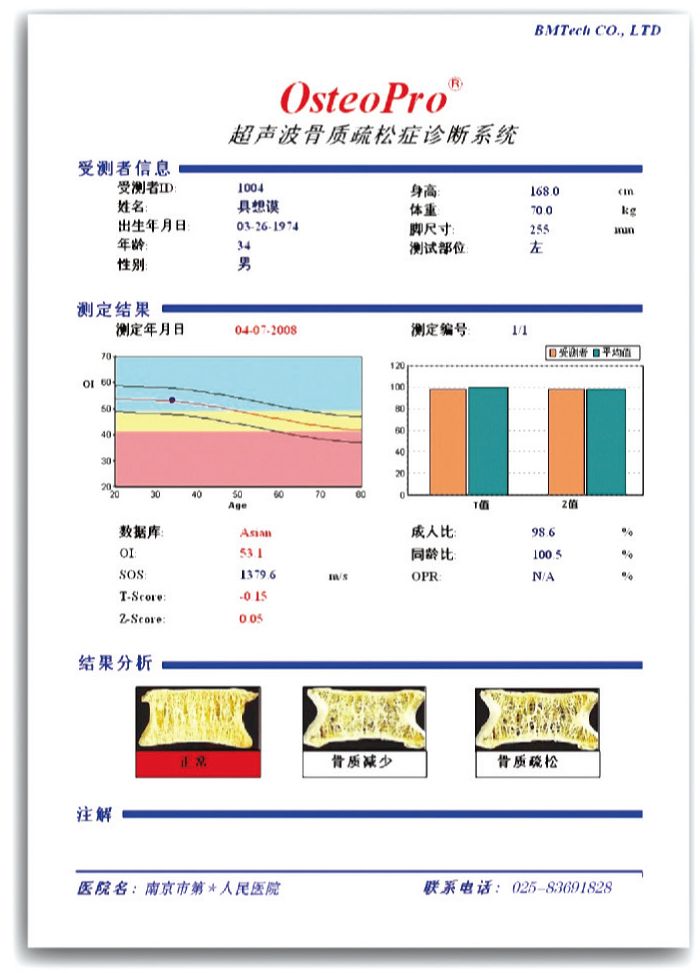 浙江金華市超聲骨密度儀多少錢