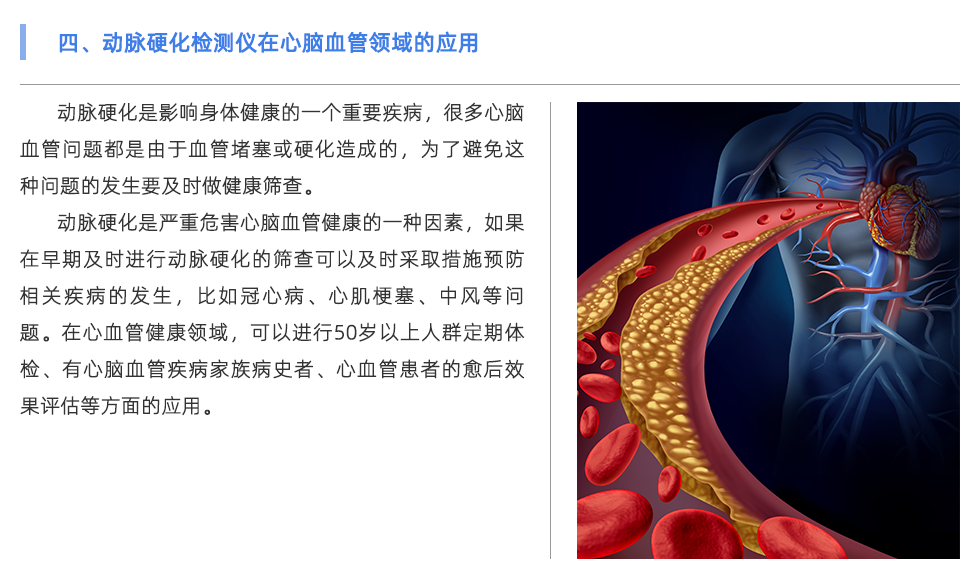 动脉硬化检测仪