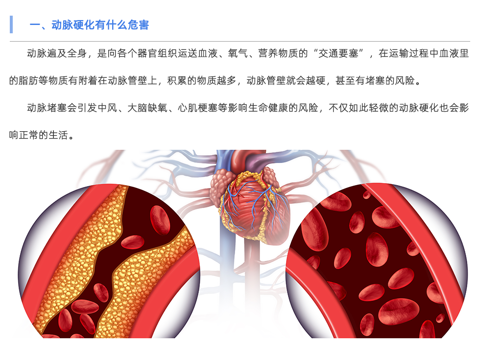 动脉硬化检测仪