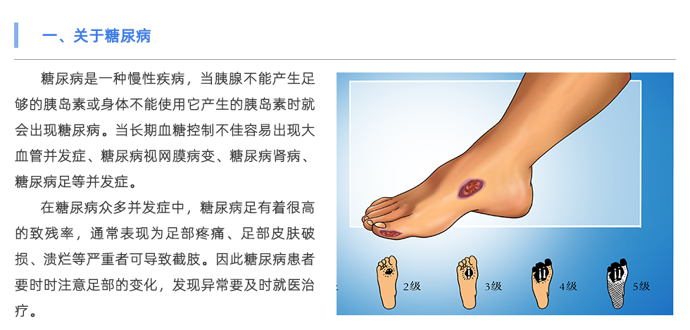 定制鞋垫