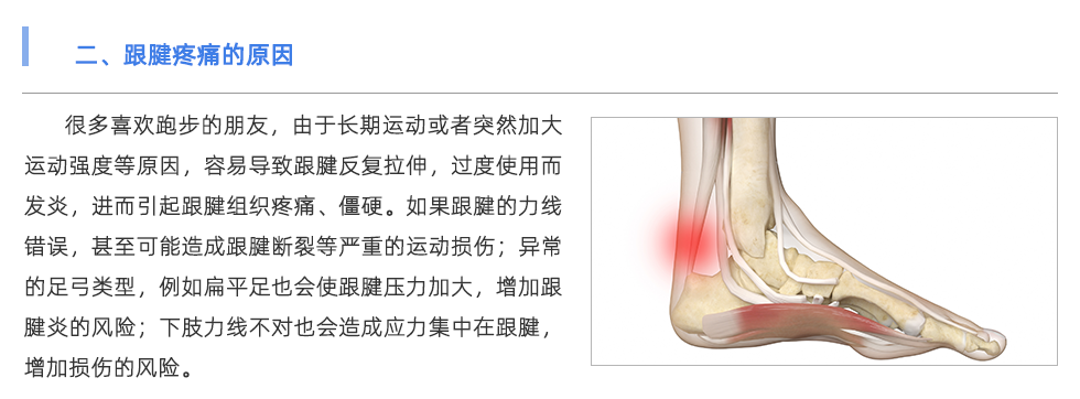 定制鞋垫