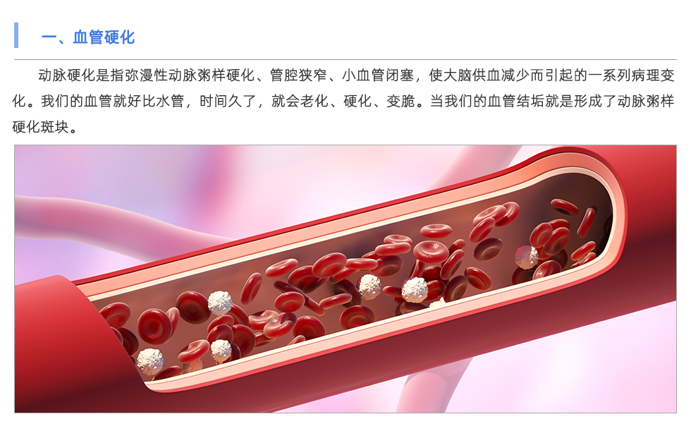 动脉硬化检测仪