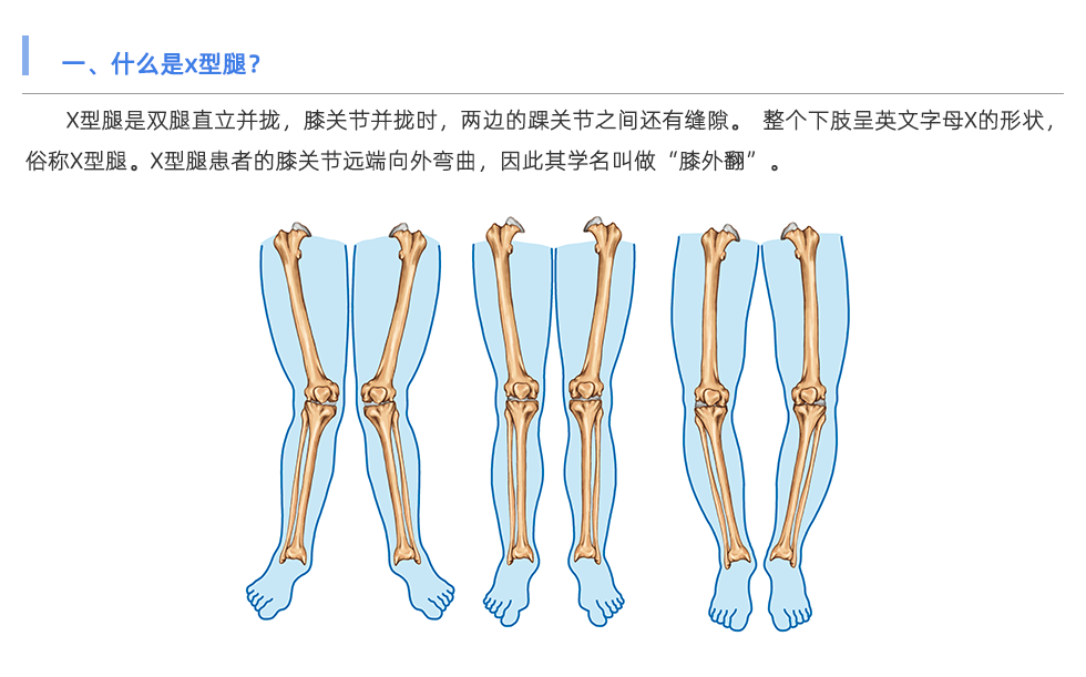 步态分析仪