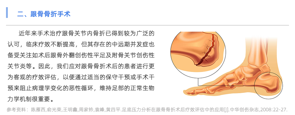 足底压力分析系统