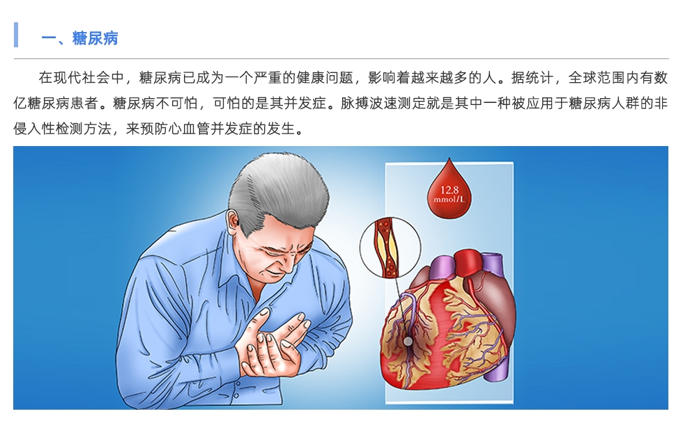 脉搏波速测定仪