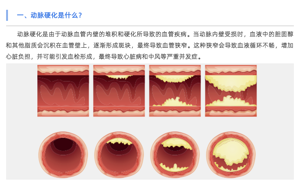 动脉硬化分析仪