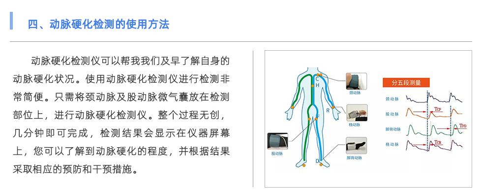 动脉硬化检测仪