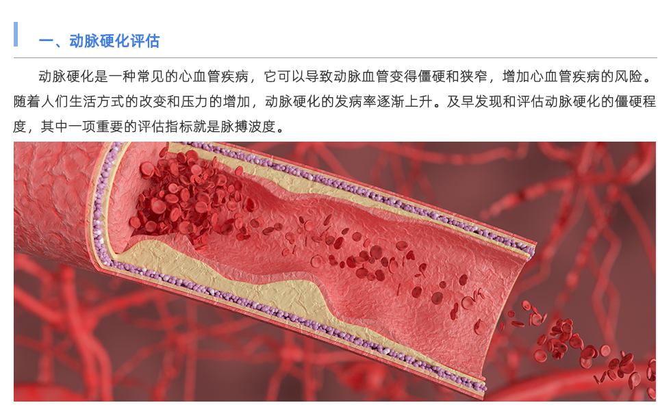 动脉硬化检测仪