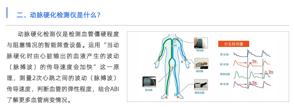 动脉硬化检测仪