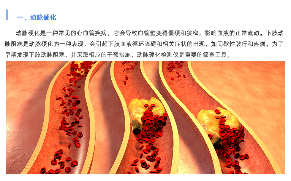 动脉硬化检测仪