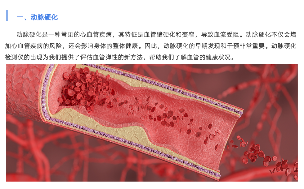 动脉硬化检测仪