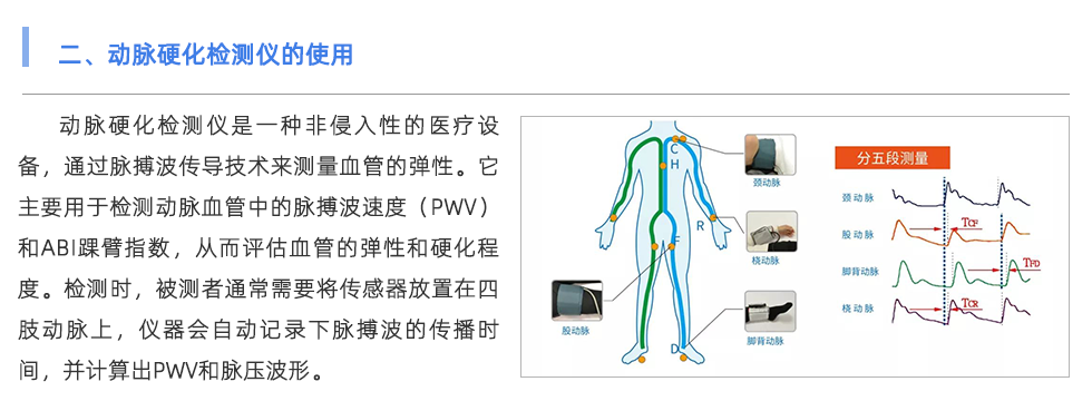 动脉硬化检测仪