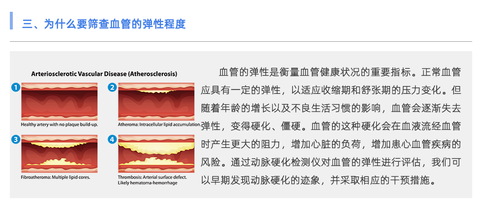 动脉硬化检测仪