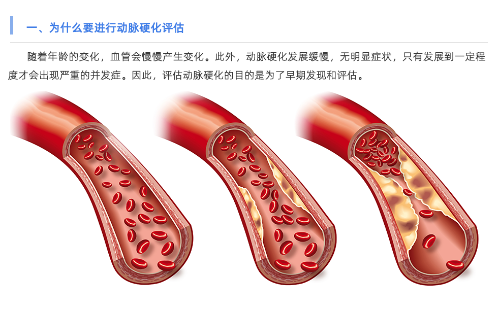 动脉硬化检测仪