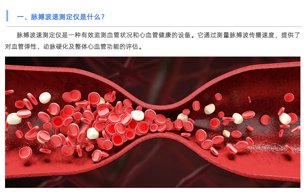 脉搏波速测定仪