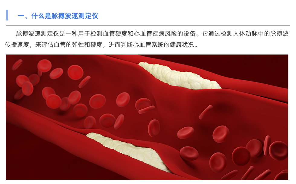 脉搏波速测定仪