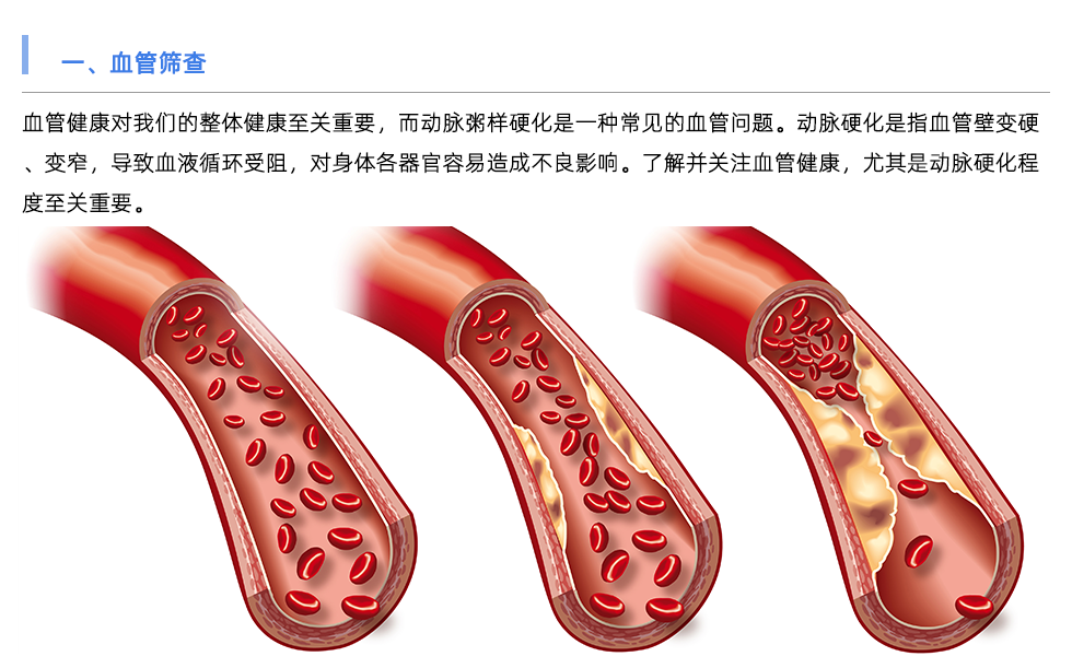 动脉硬化检测仪