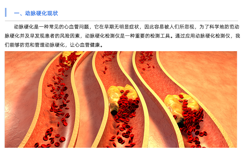 动脉硬化检测仪