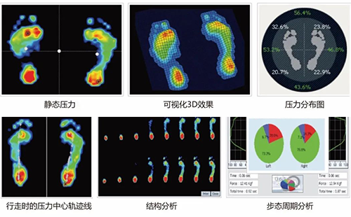 足底压力检测仪