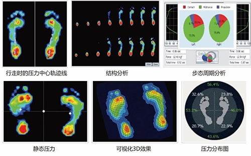 足底压力分析仪