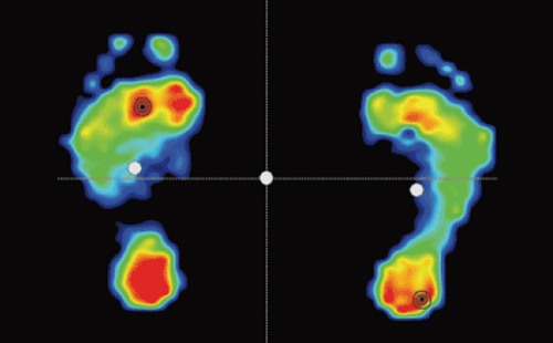 足底压力分析系统