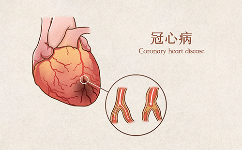 动脉硬化分析仪