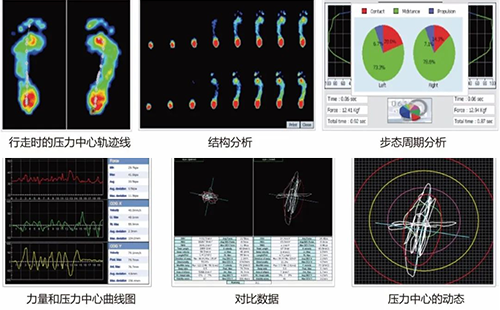 足底压力测试仪
