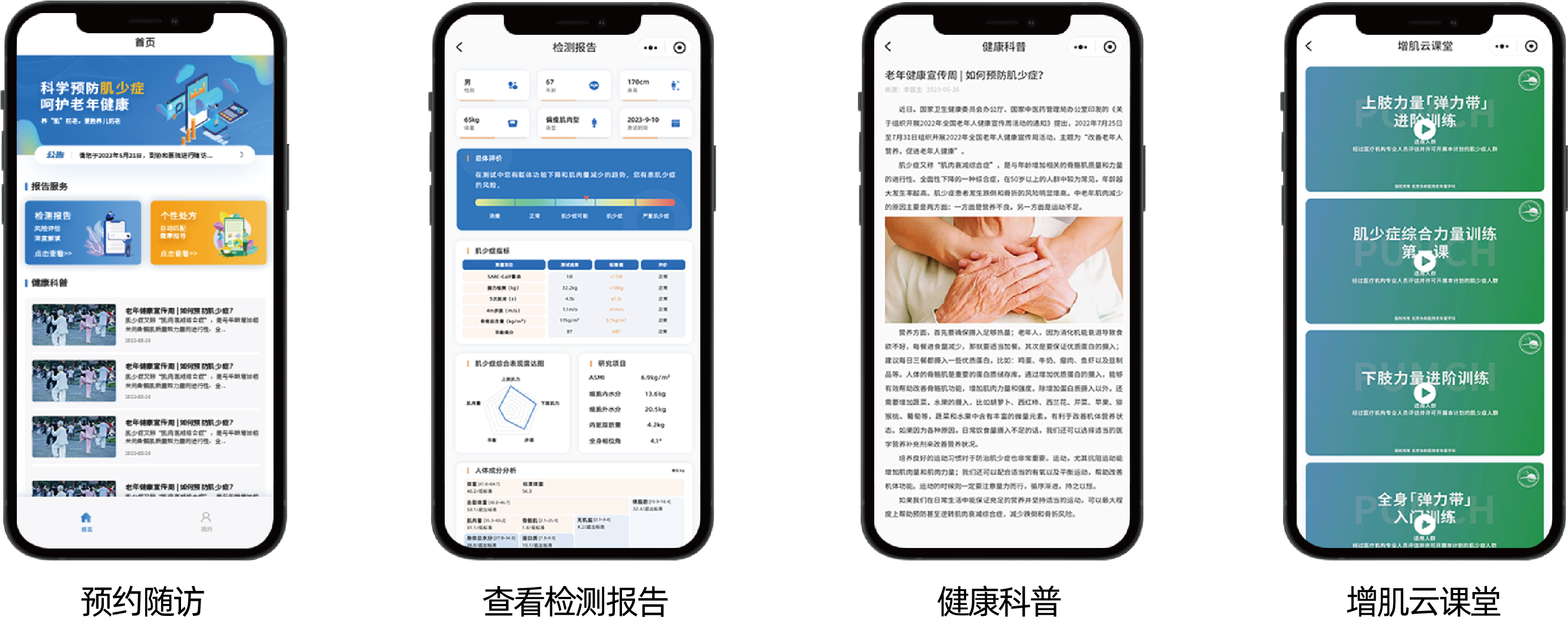 肌少症数字化评估与干预系统