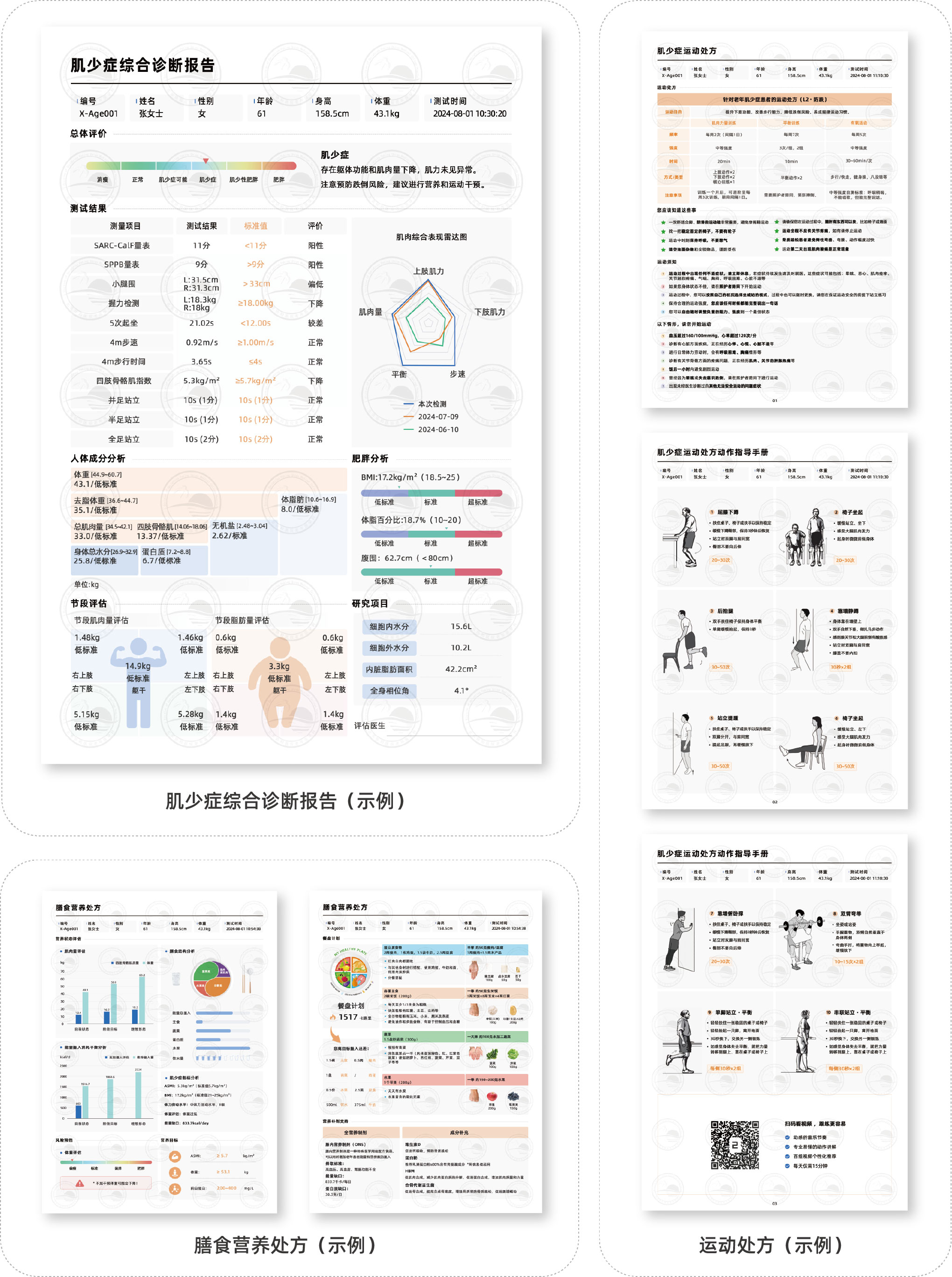 肌少症数字化评估与干预系统